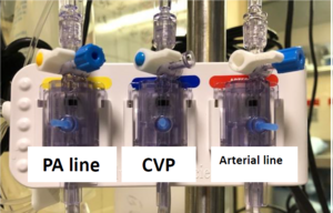 Transducer order set up.png