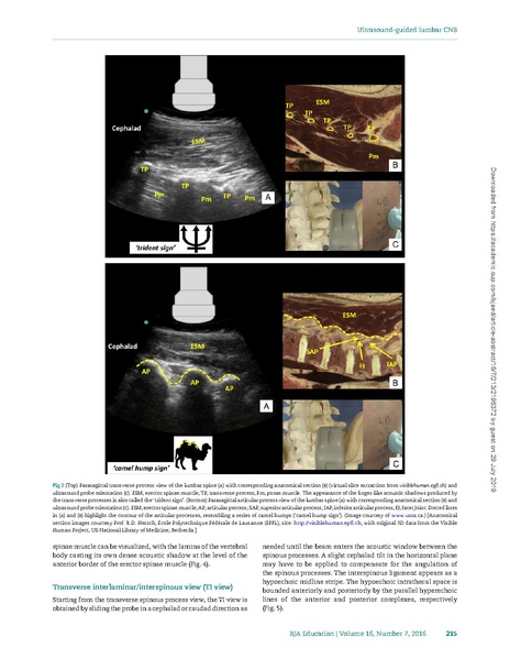 File:Ultrasound-guided lumbar central neuraxial block.pdf