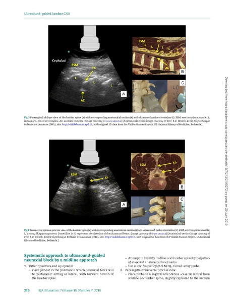 File:Ultrasound-guided lumbar central neuraxial block.pdf