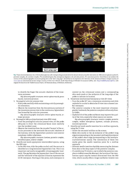 File:Ultrasound-guided lumbar central neuraxial block.pdf
