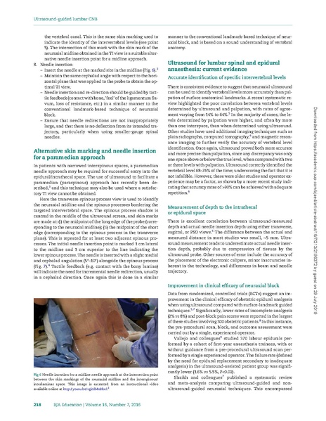 File:Ultrasound-guided lumbar central neuraxial block.pdf