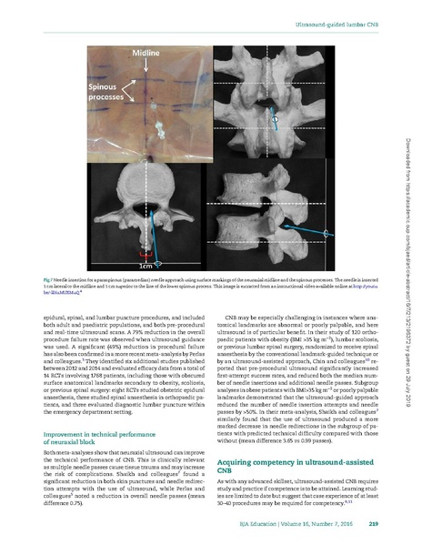 File:Ultrasound-guided lumbar central neuraxial block.pdf