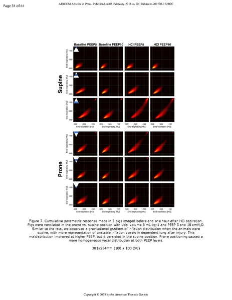 File:Xin AJRCCM 2018 - Ct of prone patients with ARDS.pdf