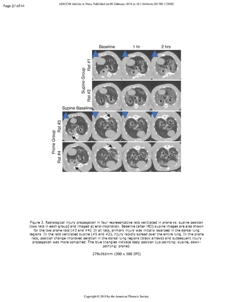 File:Xin AJRCCM 2018 - Prone positioning limits lung injury.pdf