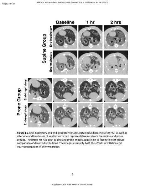 File:Xin AJRCCM 2018 - Prone positioning limits lung injury.pdf
