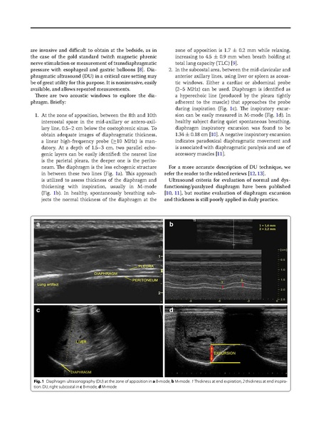 File:Zambon Intensive Care Med 2016 - Diaphragm Assessment with Ultrasound.pdf