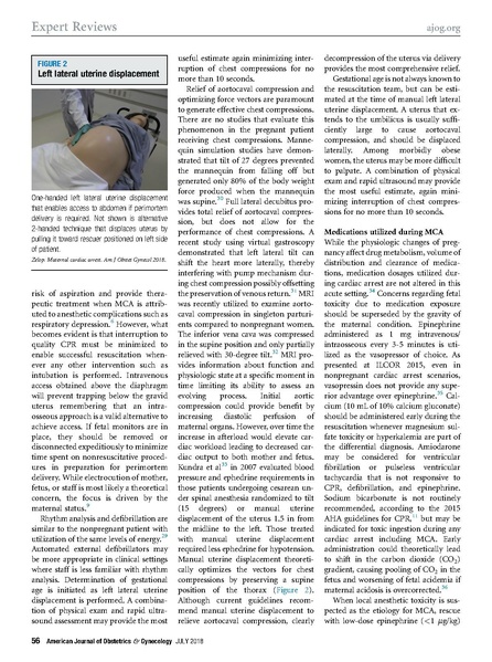 File:Zelop 2018 AJOG Cardiac arrest during pregnancy expert review.pdf