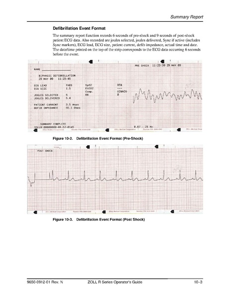 File:Zoll R Series ALS manual.pdf