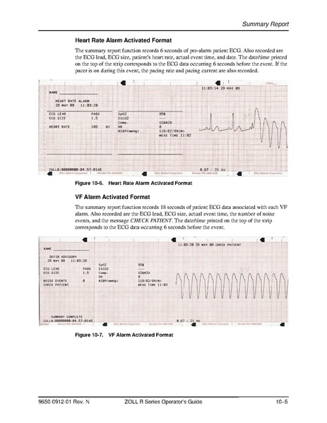 File:Zoll R Series ALS manual.pdf