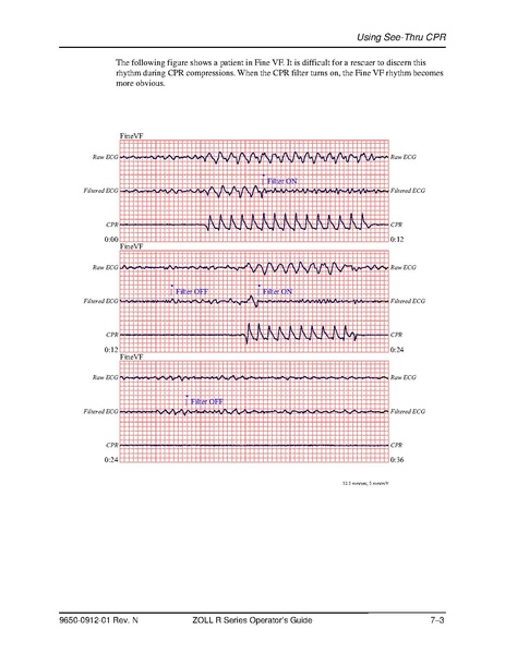 File:Zoll R Series ALS manual.pdf