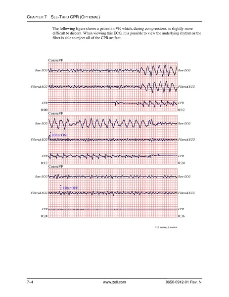 File:Zoll R Series ALS manual.pdf
