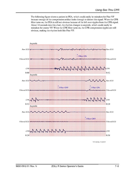 File:Zoll R Series ALS manual.pdf