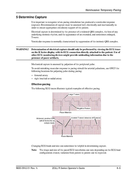 File:Zoll R Series ALS manual.pdf